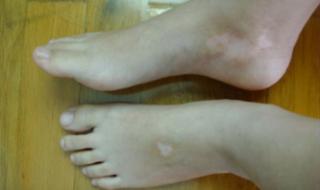 下霰是什么征兆 下霰是什么征兆