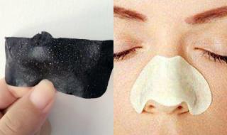 鼻子有黑头怎么去除 鼻子有黑头怎么去除