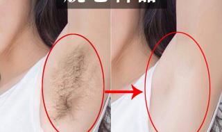 永久脱毛需要多少钱 永久脱毛需要多少钱