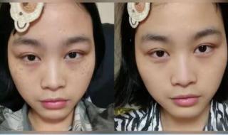 最好的去斑产品